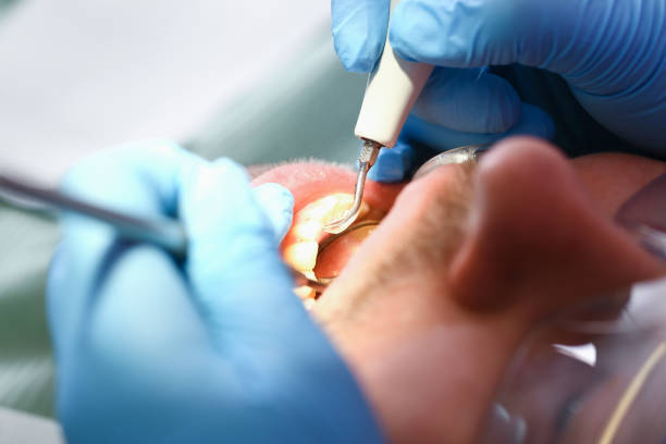 Best Broken Tooth Emergency  in Avoca, IA