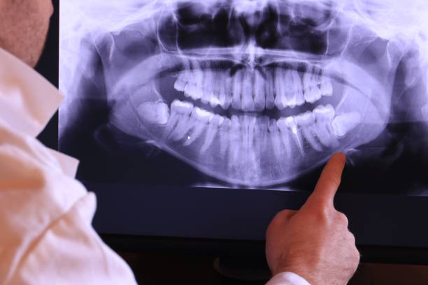Best Knocked-Out Tooth Emergency  in Avoca, IA