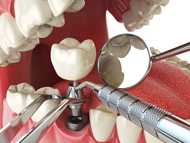 Best Cracked Tooth Emergency Dentist  in Avoca, IA